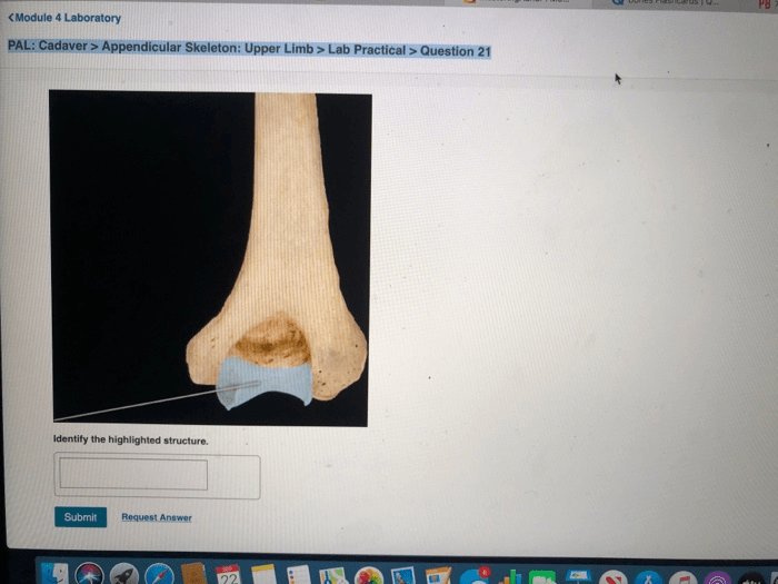 Identify the highlighted structure upper limb