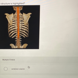 Identify the highlighted structure upper limb