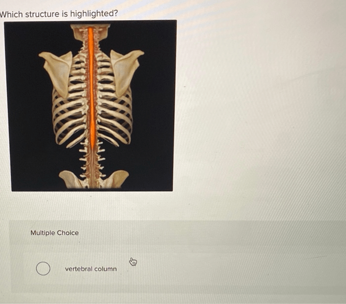 Identify the highlighted structure upper limb